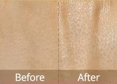 Действие крема3_4