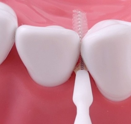 Атоми Ершики для очищения межзубного пространства SS